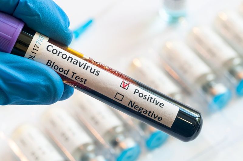 Η κλινική πορεία της σοβαρής Covid-19 σε παιδιά και ενήλικες