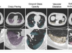 Figure 1 Ενδείξεις κακώσεων