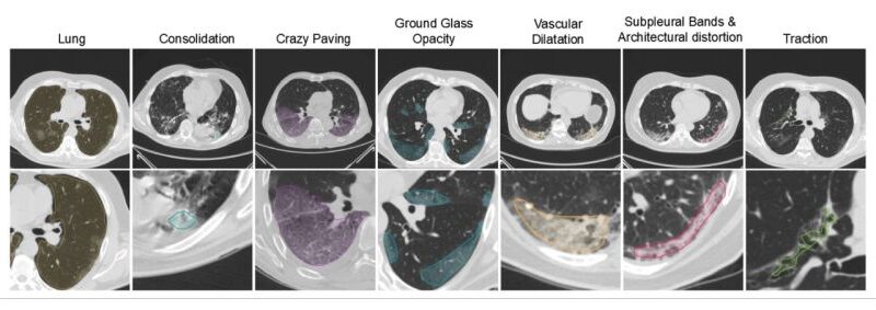 Figure 1 Ενδείξεις κακώσεων