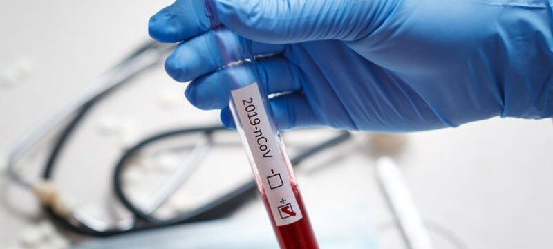 blood-test-tube-doctor-hand-mers-cov-coronavirus-test-positive-label-hospital-blood-test-tube-analysis-2019-ncov-virus-infection-originating-wuhan-china_159057-636