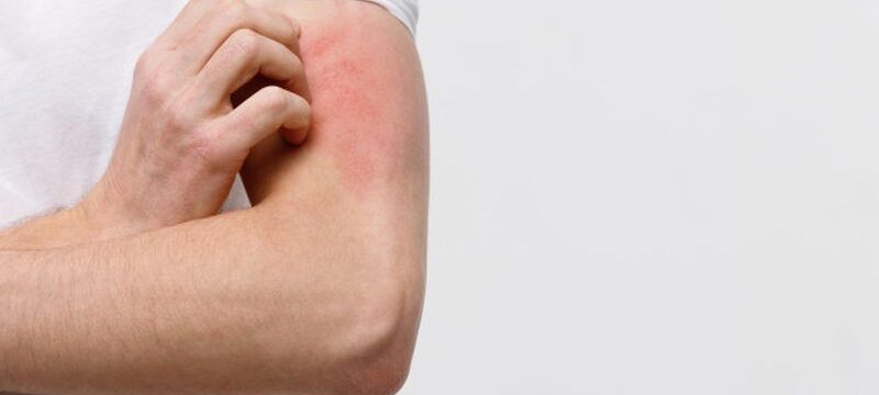 close-up-male-scratching-itch-his-hand-isolated-grey-background_165285-3