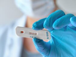 doctor-medtech-shows-rapid-laboratory-covid-19-test-detect-igm-igg-antibodies-novel-coronavirus-sars-cov-2-with-positive-result-immunity-covid-19-respiratory-viral-pneumonia_87646-7002