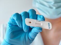 doctor-shows-rapid-laboratory-covid-19-test-detection-igm-igg-antibodies-novel-coronavirus-sars-cov-2-with-positive-result-herd-immunity-protects-population-from-this-new-virus_87646-7005