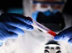 male-chemist-hand-blue-protective-gloves-hold_151013-4789