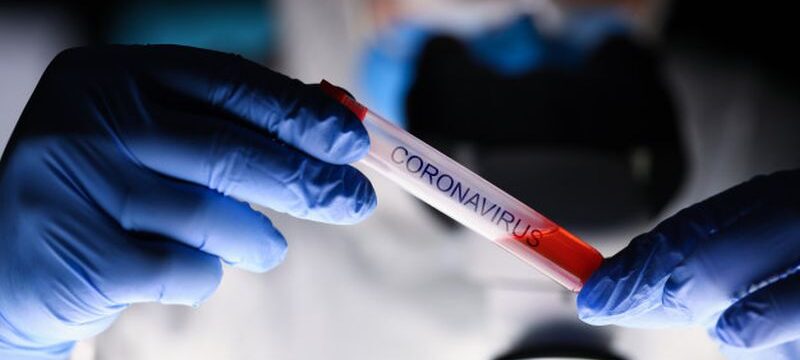 male-chemist-hand-blue-protective-gloves-hold_151013-4789