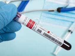 Blood samples with infected virus