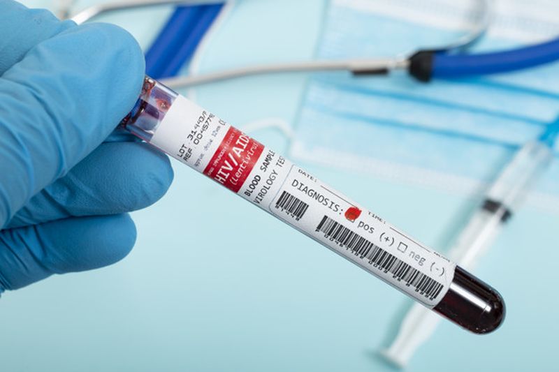 Συμφωνία MSD και Gilead για την ανάπτυξη θεραπειών για τον HIV