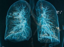 chest-x-rays-3d-image_35666-215