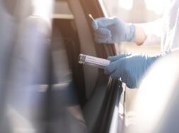coronavirus-test-person-wearing-gloves-car_23-2148510553