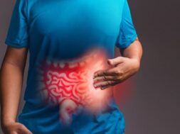 irritable-bowel-syndrome_44282-215