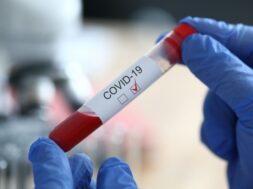 male-chemist-hand-blue-protective-gloves-hold_151013-6501