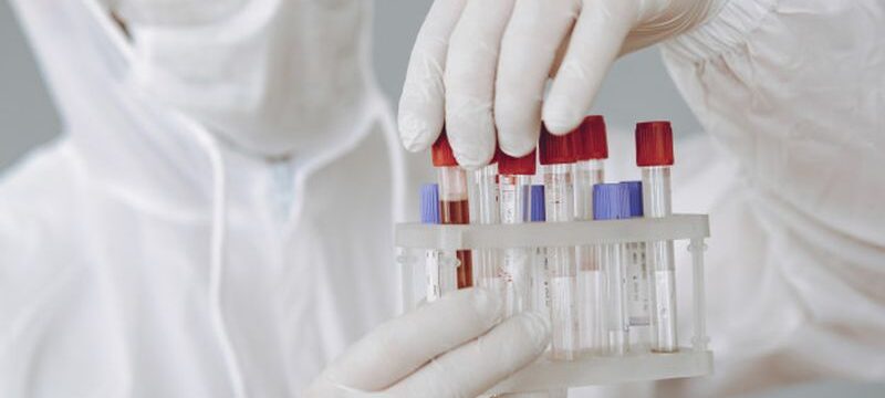 man-protective-suit-glasses-working-laboratory_1157-34434