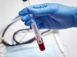 blood-test-tube-doctor-hand-mers-cov-coronavirus-test-positive-label-hospital-blood-test-tube-analysis-2019-ncov-virus-infection-originating-wuhan-china_159057-636