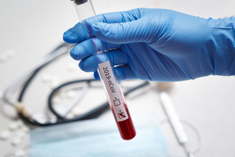 Ά. Φάουτσι: Αμφιβολίες για τη φυσική προέλευση του κορωνοϊoύ