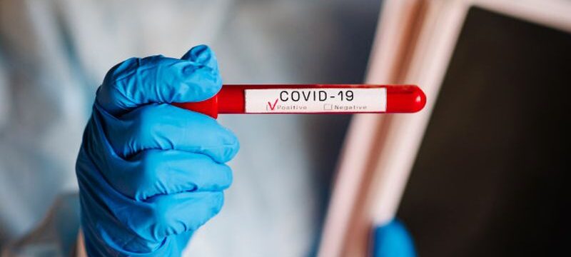 coronavirus-hands-doctor-nurse-protective-suit-hold-test-tube-with-biological-sample-covid-19-conduct-laboratory-test-positive-result-blood-is-infected-new-cases-infection_180731-140