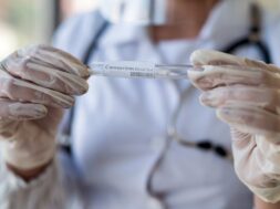 female-hand-holding-covid-19-swab-collection-kit-performing-patient-nasal-swabbing-medical-equipment_359031-5591