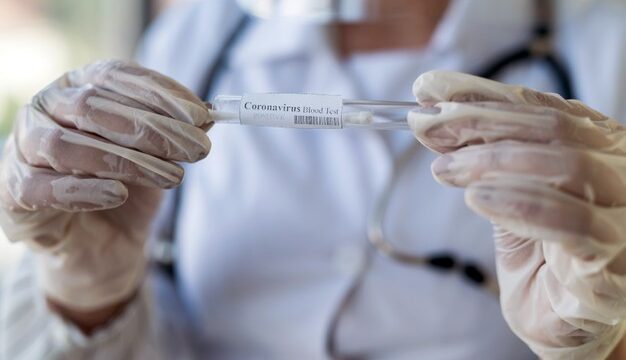 female-hand-holding-covid-19-swab-collection-kit-performing-patient-nasal-swabbing-medical-equipment_359031-5591