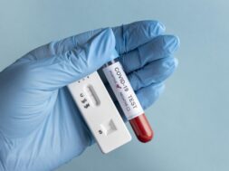 hand-with-protective-gloves-holding-blood-sample-covid-test_23-2148958351