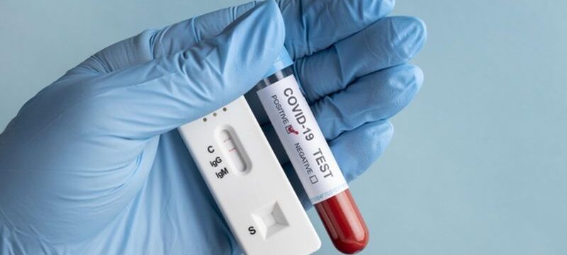 hand-with-protective-gloves-holding-blood-sample-covid-test_23-2148958351