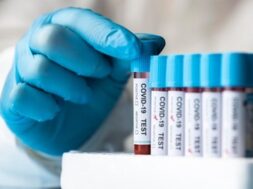 hand-with-protective-gloves-holding-blood-samples-covid-test_23-2148958407