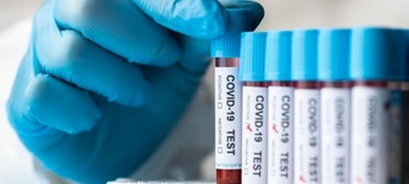 hand-with-protective-gloves-holding-blood-samples-covid-test_23-2148958407