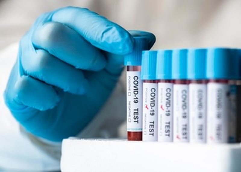 Αποτελέσματα ελέγχων μαζικών δειγματοληψιών από τις ΚΟΜΥ του ΕΟΔΥ