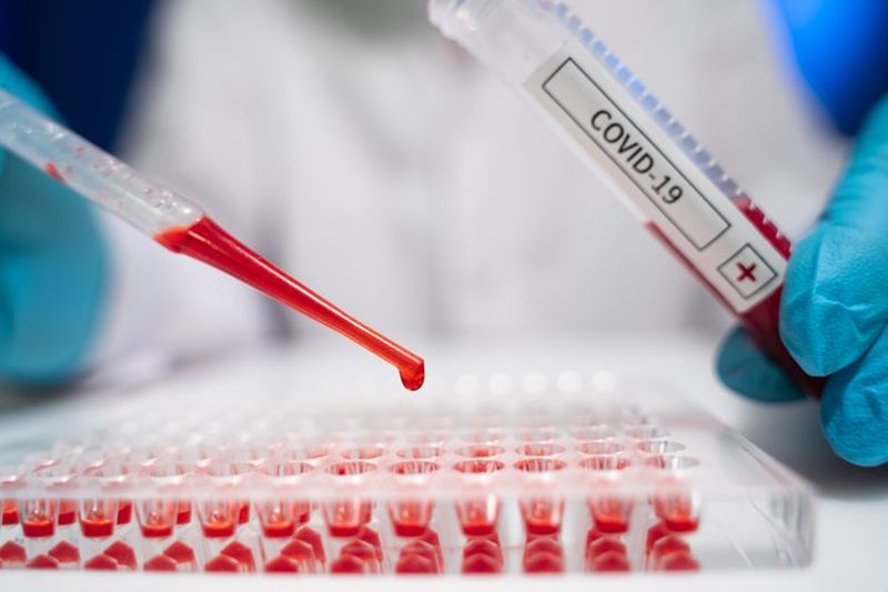 Νέα διαγνωστικά τεστ για την COVID-19 προς την ανάλυση των ειδικών Τ-λεμφοκυττάρων