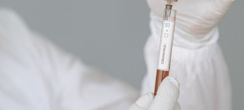 man-protective-suit-glasses-working-laboratory_1157-34429