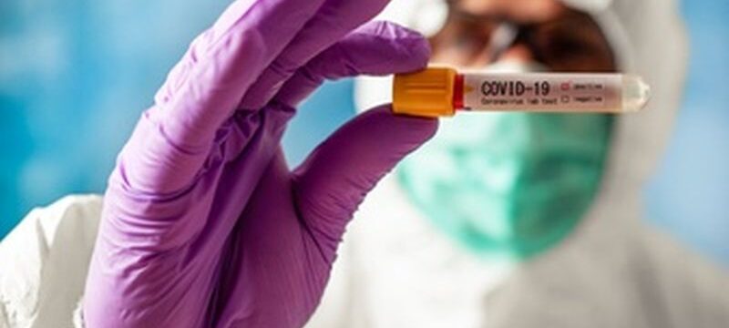 scientist-wearing-respirator-mask-holding-positive-blood-test-result-new-rapidly-spreading-coronavirus_179314-37
