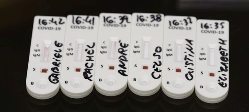 test kit for viral disease COVID-19