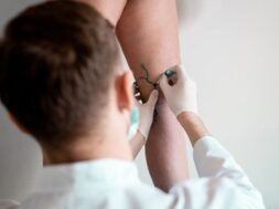 vein-markup-vascular-surgeon-is-marking-veins-varicose-surgery_255847-705