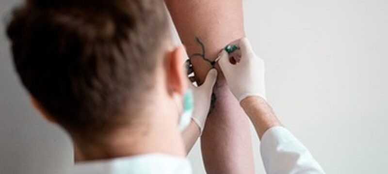 vein-markup-vascular-surgeon-is-marking-veins-varicose-surgery_255847-705