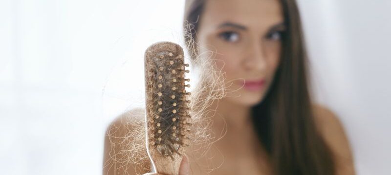 Hair Loss. Upset Woman Holding Brush With Hair