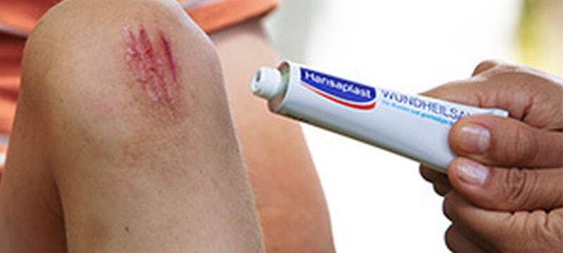 HANSAPLAST_media alert (3)