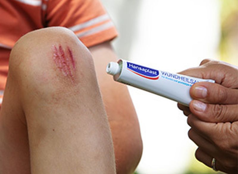 Hansaplast: Συνέχισε να απολαμβάνεις τη μαγεία του παιχνιδιού. Σε καλύπτουμε!