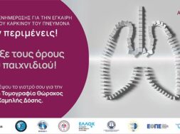 VISUAL_ΕΚΣΤΡΑΤΕΙΑ ΕΝΗΜΕΡΩΣΗΣ ΜΗΝ ΠΕΡΙΜΕΝΕΙΣ