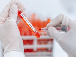 close-up-scientist-puts-check-mark-tube-with-test_160672-7101