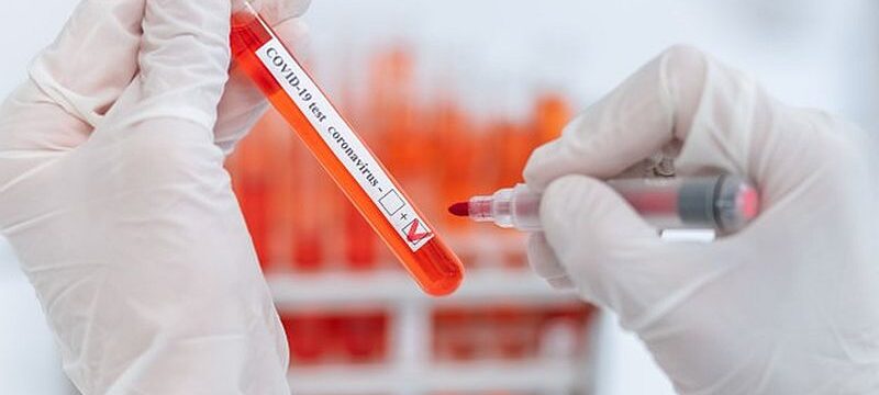 close-up-scientist-puts-check-mark-tube-with-test_160672-7101