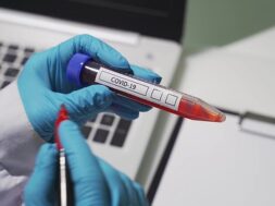 closeup-microbiologist-medical-worker-hand-with-blue-surgical-gloves-marking-blood-test-result-as-positive-new-rapidly-spreading-coronavirus-covid-19-positive-concept_159160-1807