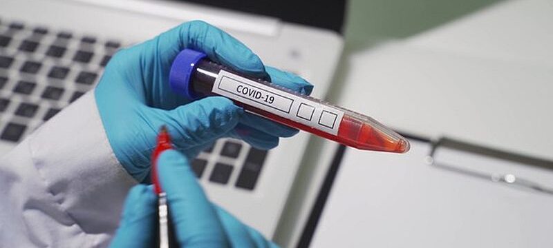 closeup-microbiologist-medical-worker-hand-with-blue-surgical-gloves-marking-blood-test-result-as-positive-new-rapidly-spreading-coronavirus-covid-19-positive-concept_159160-1807