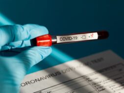 positive-blood-test-result-new-rapidly-spreading-coronavirus_114309-544