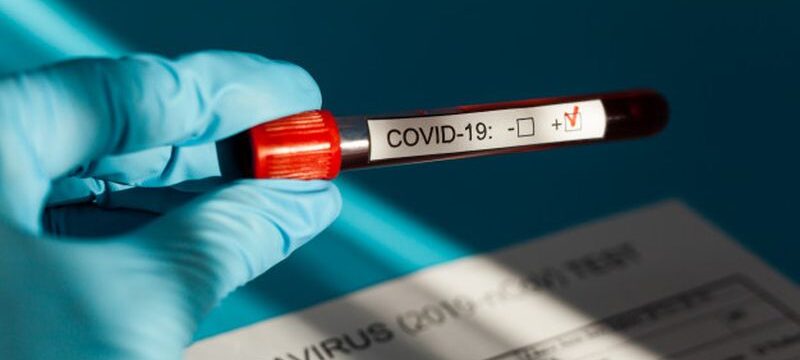 positive-blood-test-result-new-rapidly-spreading-coronavirus_114309-544