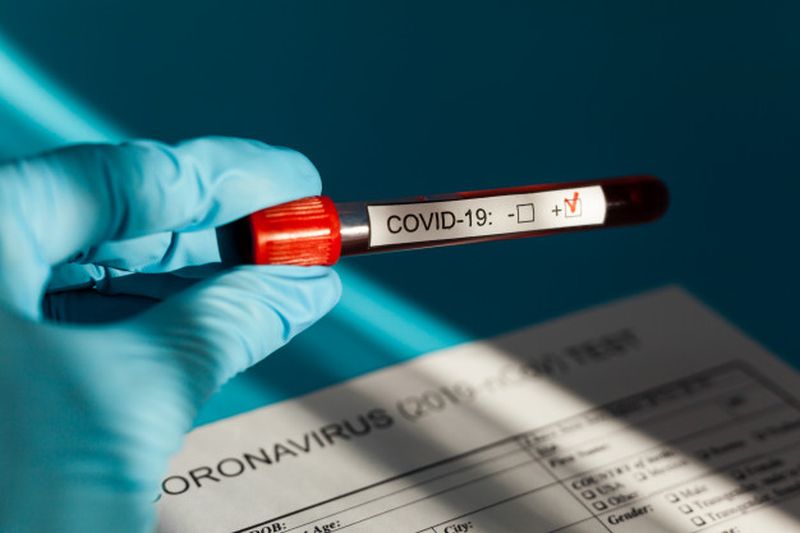 Παρατεταμένα συμπτώματα μακρόχρονης Covid-19 για τους παχύσαρκους