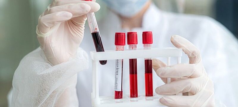 pretty-nurse-white-medical-uniform-holding-test-tube-with-blood_359031-2283