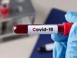 surgeon-holding-coronavirus-blood-test-tube_53876-95286