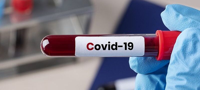 surgeon-holding-coronavirus-blood-test-tube_53876-95286