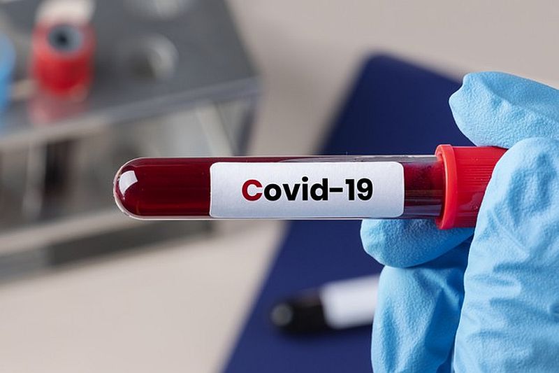 Πόσο πιθανό είναι ο COVID-19 να διέφυγε από εργαστήριο: Τι γνωρίζουν και τι όχι οι επιστήμονες