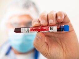 doctor-holding-test-tube-blood-sample_69593-8566 (1)