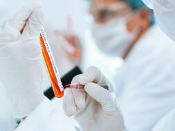 labelled-tube-with-coronavirus-test-hands-laboratory-assistant_160672-3136