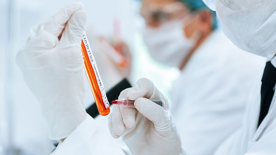 Δρ. Άντονι Φαούτσι: Δεν είναι απαραίτητος ο έλεγχος των αντισωμάτων έναντι του SARS-CoV-2